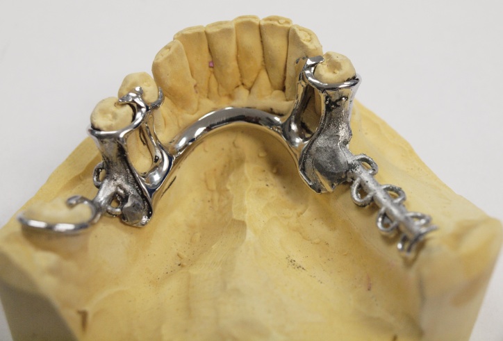 Pr tesis Removibles Laboratorio Dental Marzal Mateu Pr tesis Removibles Laboratorio Dental Marzal Mateu